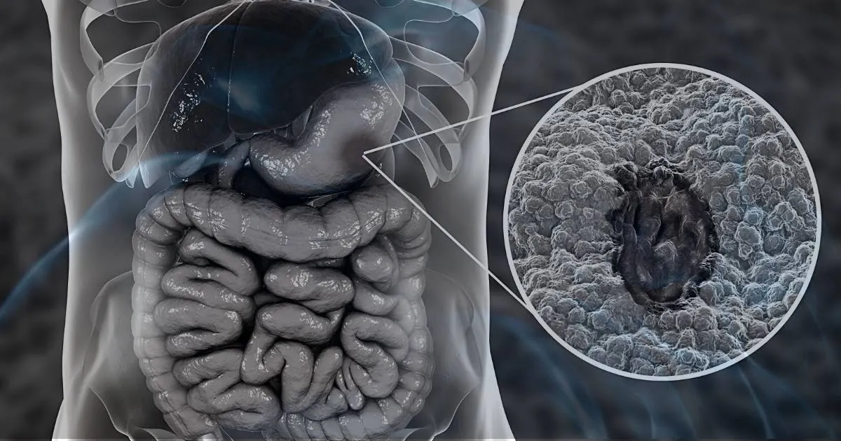 Dreaming of Ulcers: 8 Spiritual Meaning