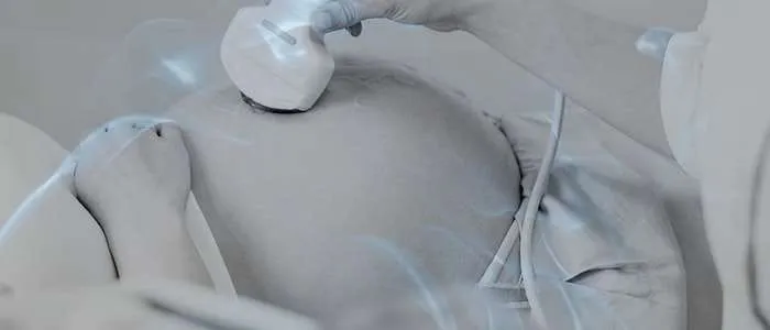 5 Spiritual Meaning of Dreaming of an Ultrasound