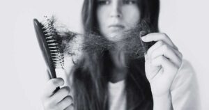 Biblical Meaning of Dreaming About Hair Loss